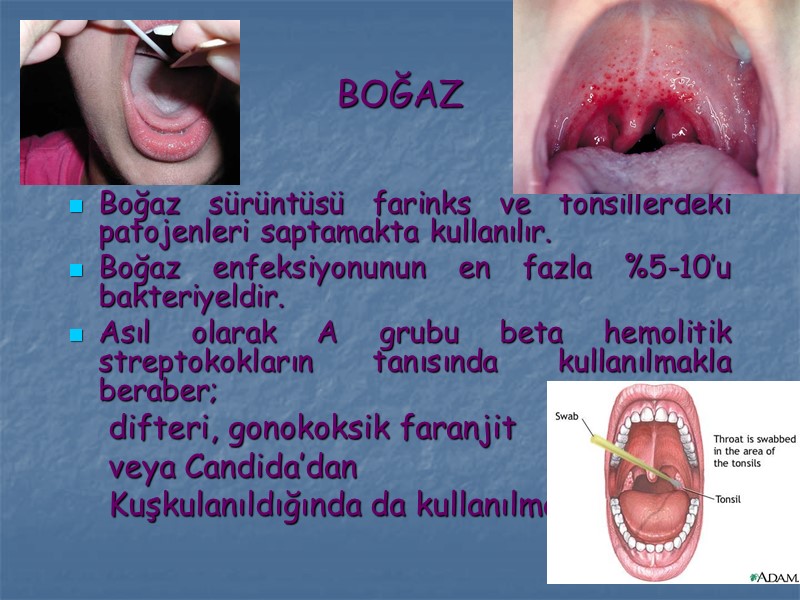 BOĞAZ Boğaz sürüntüsü farinks ve tonsillerdeki patojenleri saptamakta kullanılır. Boğaz enfeksiyonunun en fazla %5-10’u